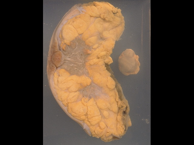 Anatomy Model Breast Cross Section